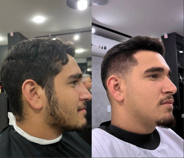 Antes e depois
